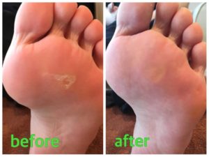 タコのbefore-after01